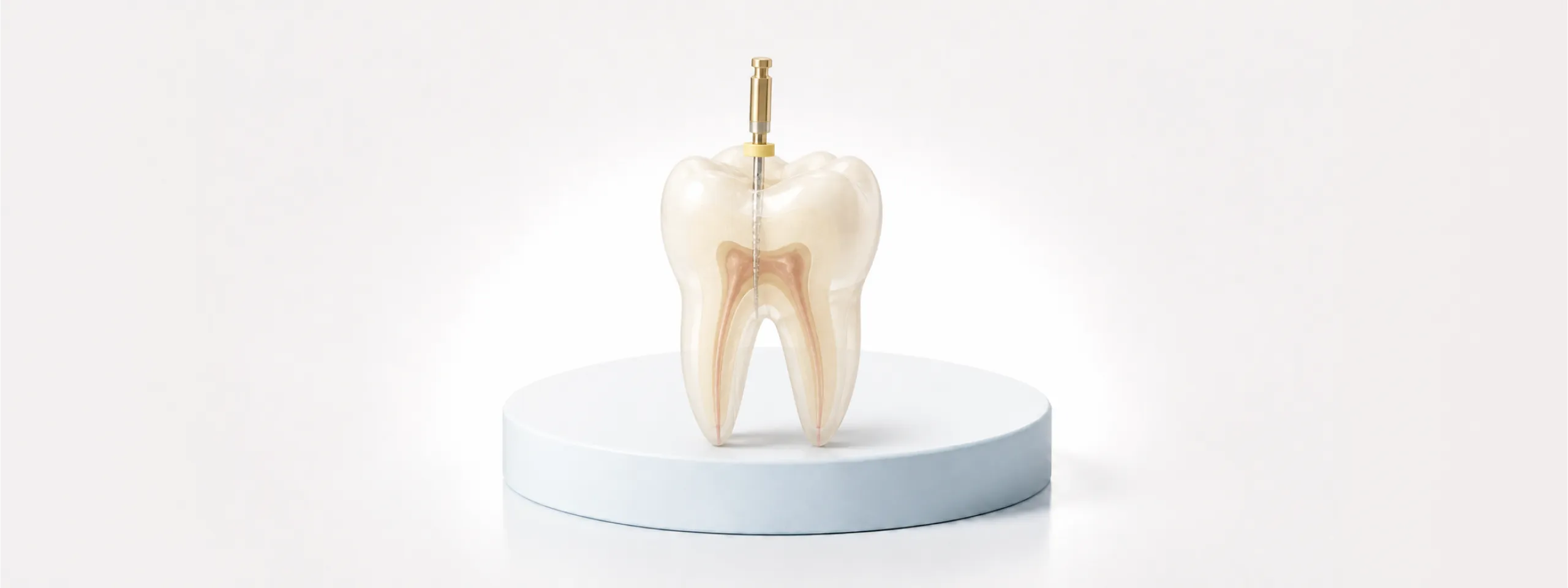 Root Canal Treatment